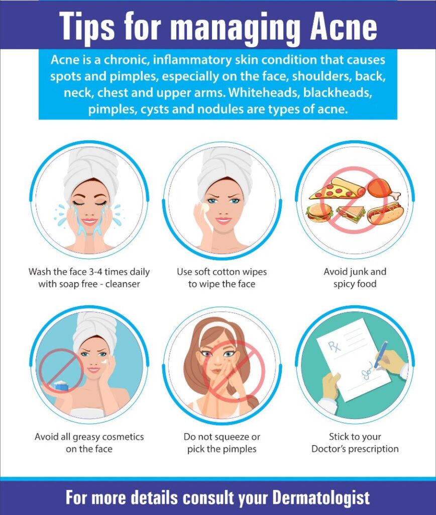 A Dermatologist’s 6 Best Tips For Managing Acne – Total Skin Pro Clinic